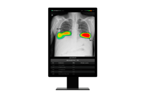 lunit-ai-diagnostics